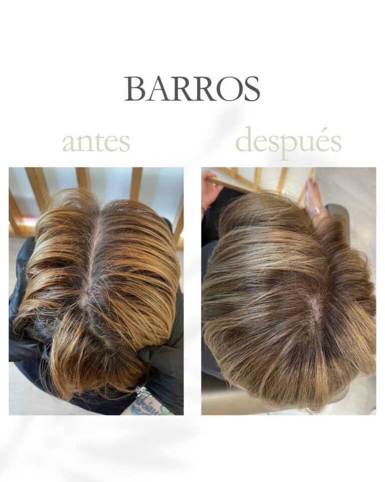 barros